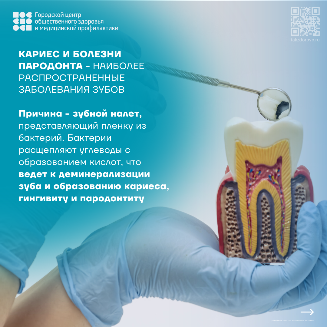 Кариес и болезни пародонта