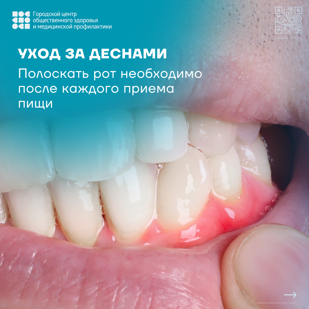 Уход за деснами